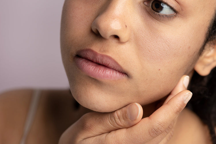 Dull dehydrated skin