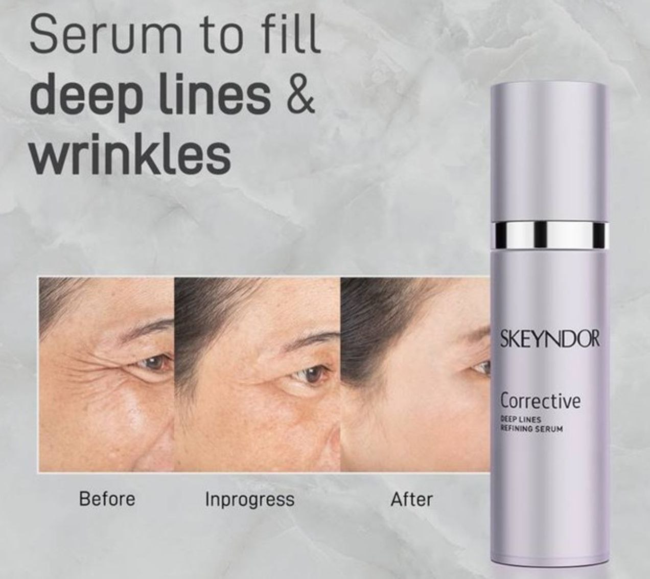 Deep   Lines   Refining   Serum